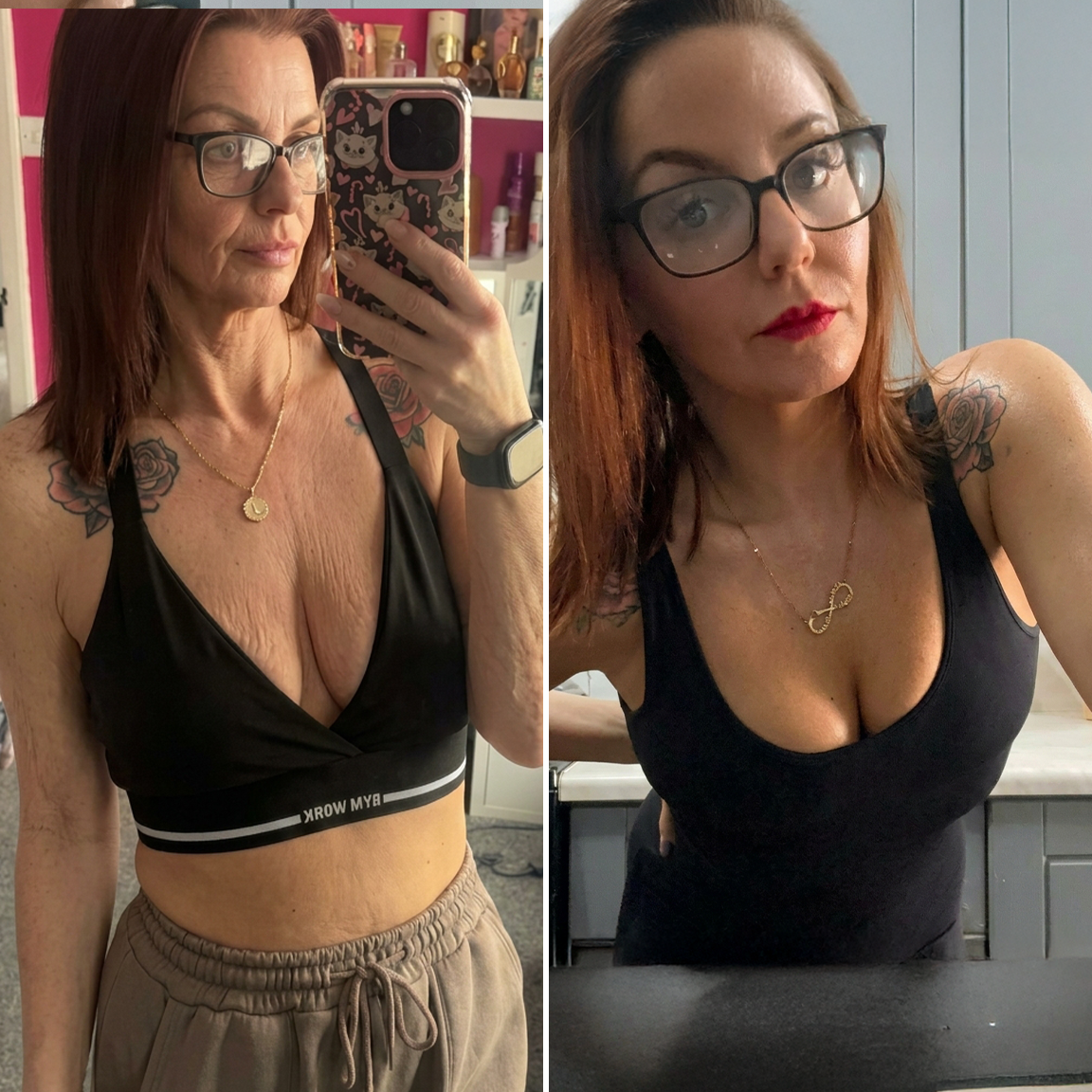 💜HISKIN® Náplasti s mikroihličkami na zväčšenie objemu, spevnenie a lifting poprsia