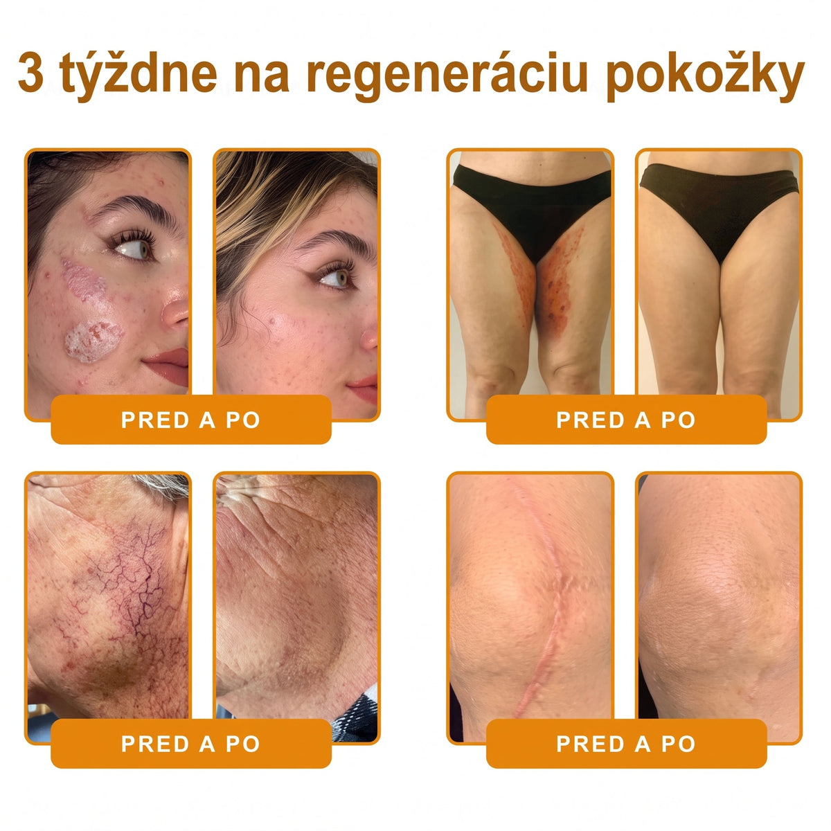 ✨ 🔥 VLSVLS® Včelí jed regeneračný krém na pokožku 🔥 Vyvinuté na Slovensku, vyrobené a dodávané zo Slovenska
