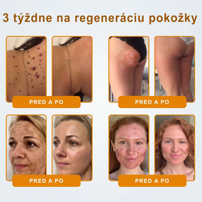 ✨ 🔥 VLSVLS® Včelí jed regeneračný krém na pokožku 🔥 Vyvinuté na Slovensku, vyrobené a dodávané zo Slovenska