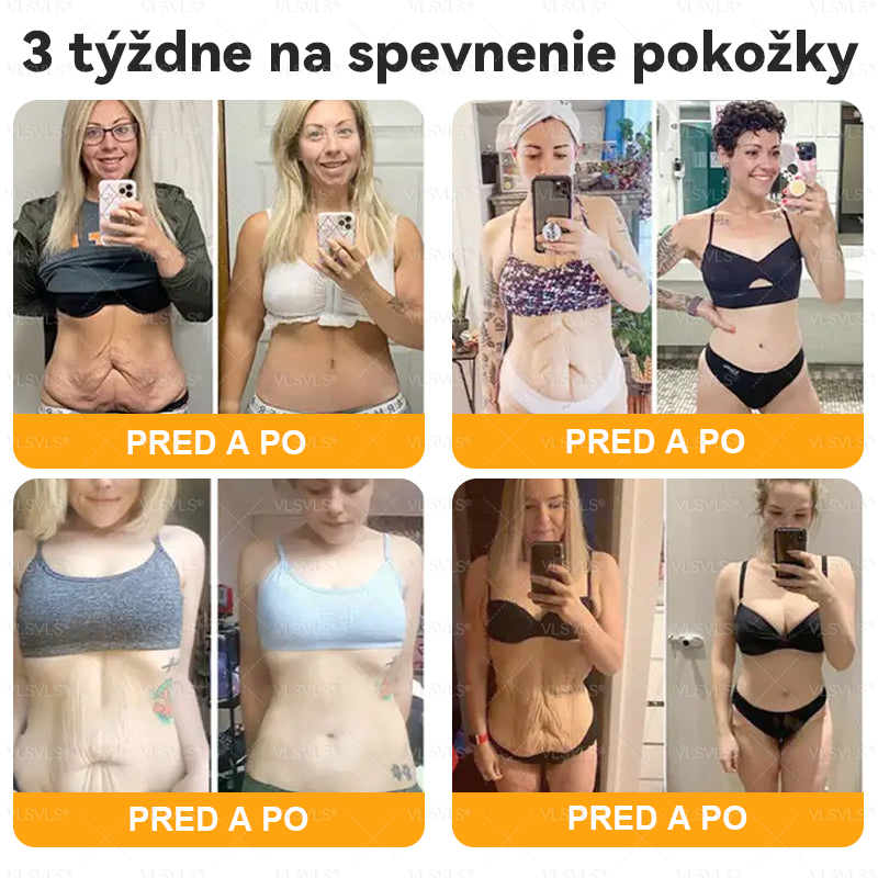 👩‍⚕️ VLSVLS® Komplexný krém s včelím jedom – POSLEDNÝ DEŇ: Zľava 80 %! (ochabnutá pokožka, jemné vrásky, strata pevnosti, ploché poprsie, ovisnuté boky a ďalšie)