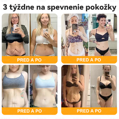 👩‍⚕️ VLSVLS® Komplexný krém s včelím jedom – POSLEDNÝ DEŇ: Zľava 80 %! (ochabnutá pokožka, jemné vrásky, strata pevnosti, ploché poprsie, ovisnuté boky a ďalšie)