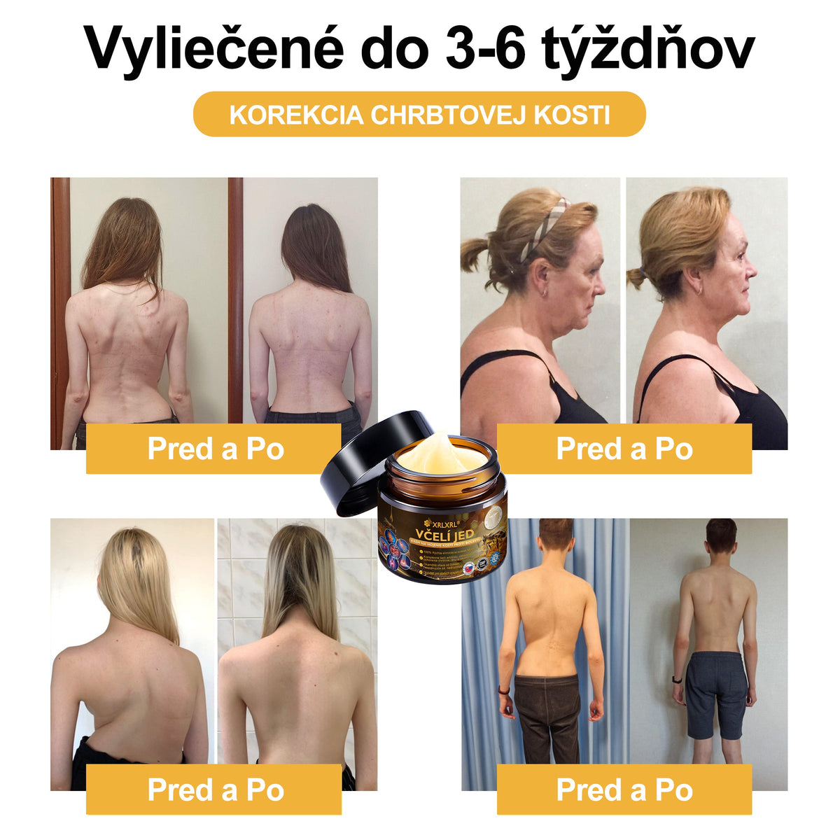XRLXRL®🎁🎁 Posledná šanca! Získajte ho teraz so zľavou 40 %!