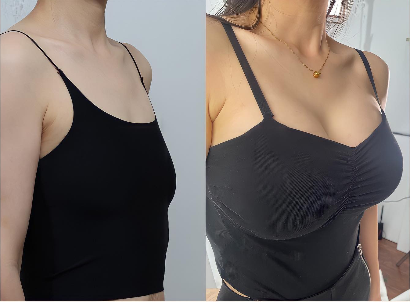 💜HISKIN® Náplasti s mikroihličkami na zväčšenie objemu, spevnenie a lifting poprsia
