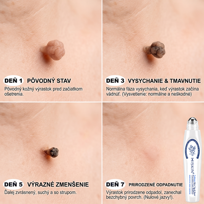 🌟HISKIN®👩‍⚕️ BOTANICKÝ – GUMA NA ŠTÍTKY A ŠKVRNY – Bezbolestná starostlivosť o pokožku bez jaziev s pokročilým guľôčkovým aplikátorom