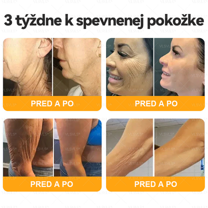 👩‍⚕️ VLSVLS® Komplexný krém s včelím jedom – POSLEDNÝ DEŇ: Zľava 80 %! (ochabnutá pokožka, jemné vrásky, strata pevnosti, ploché poprsie, ovisnuté boky a ďalšie)