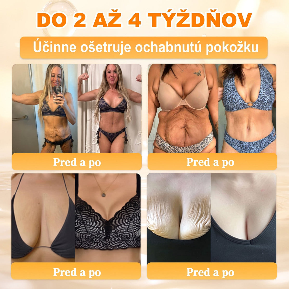 ✨ 🔥 VLSVLS® Včelí jed regeneračný krém na pokožku 🔥 Vyvinuté na Slovensku, vyrobené a dodávané zo Slovenska