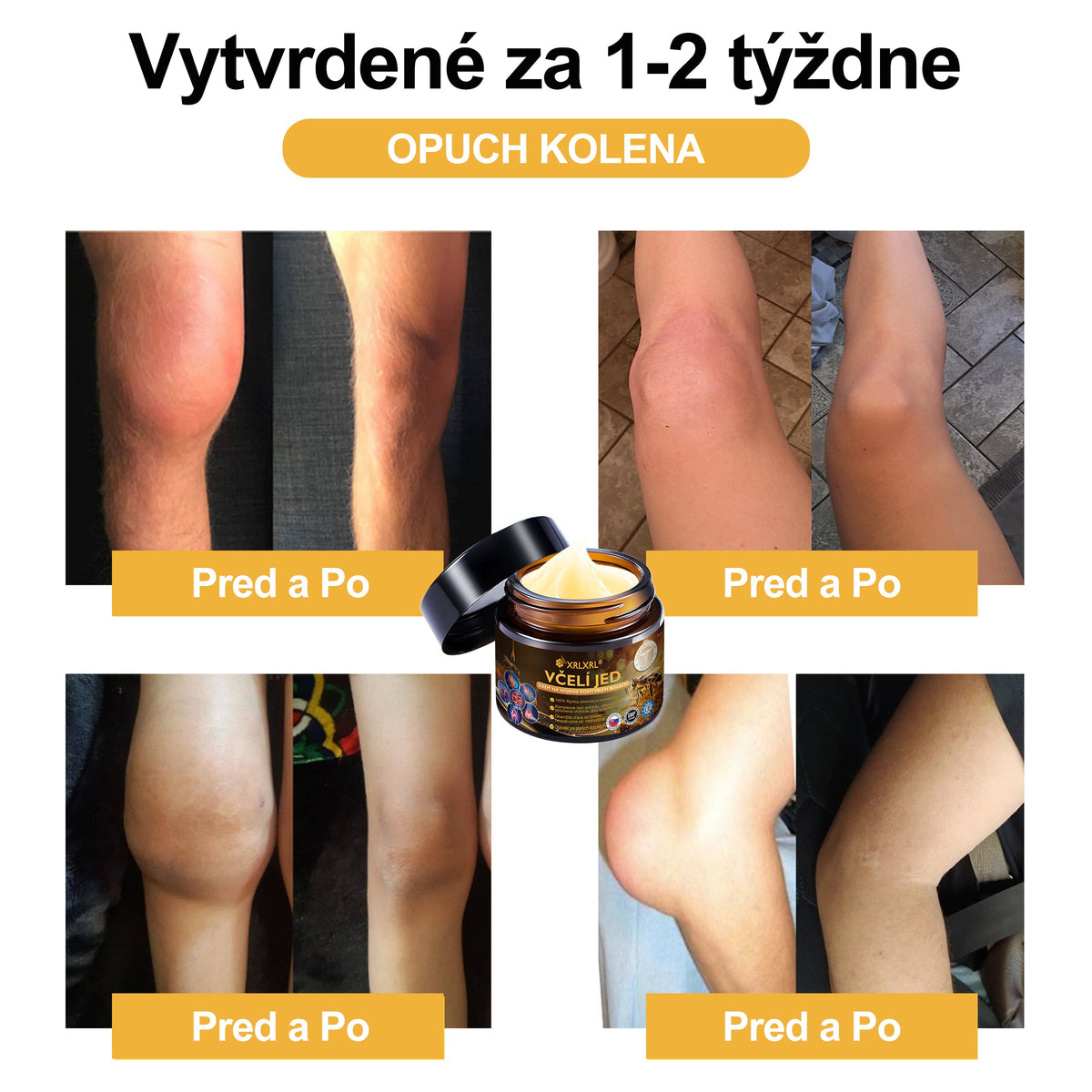 XRLXRL®🎁🎁 Posledná šanca! Získajte ho teraz so zľavou 40 %!