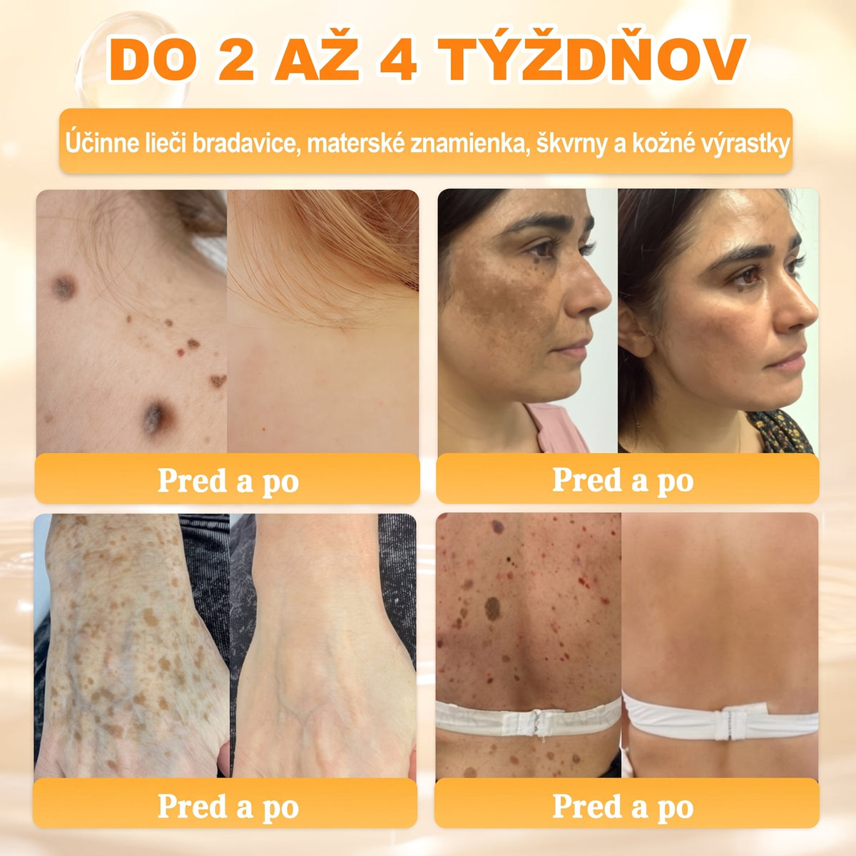 ✨ 🔥 VLSVLS® Včelí jed regeneračný krém na pokožku 🔥 Vyvinuté na Slovensku, vyrobené a dodávané zo Slovenska