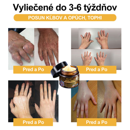 XRLXRL®🎁🎁 Posledná šanca! Získajte ho teraz so zľavou 40 %!