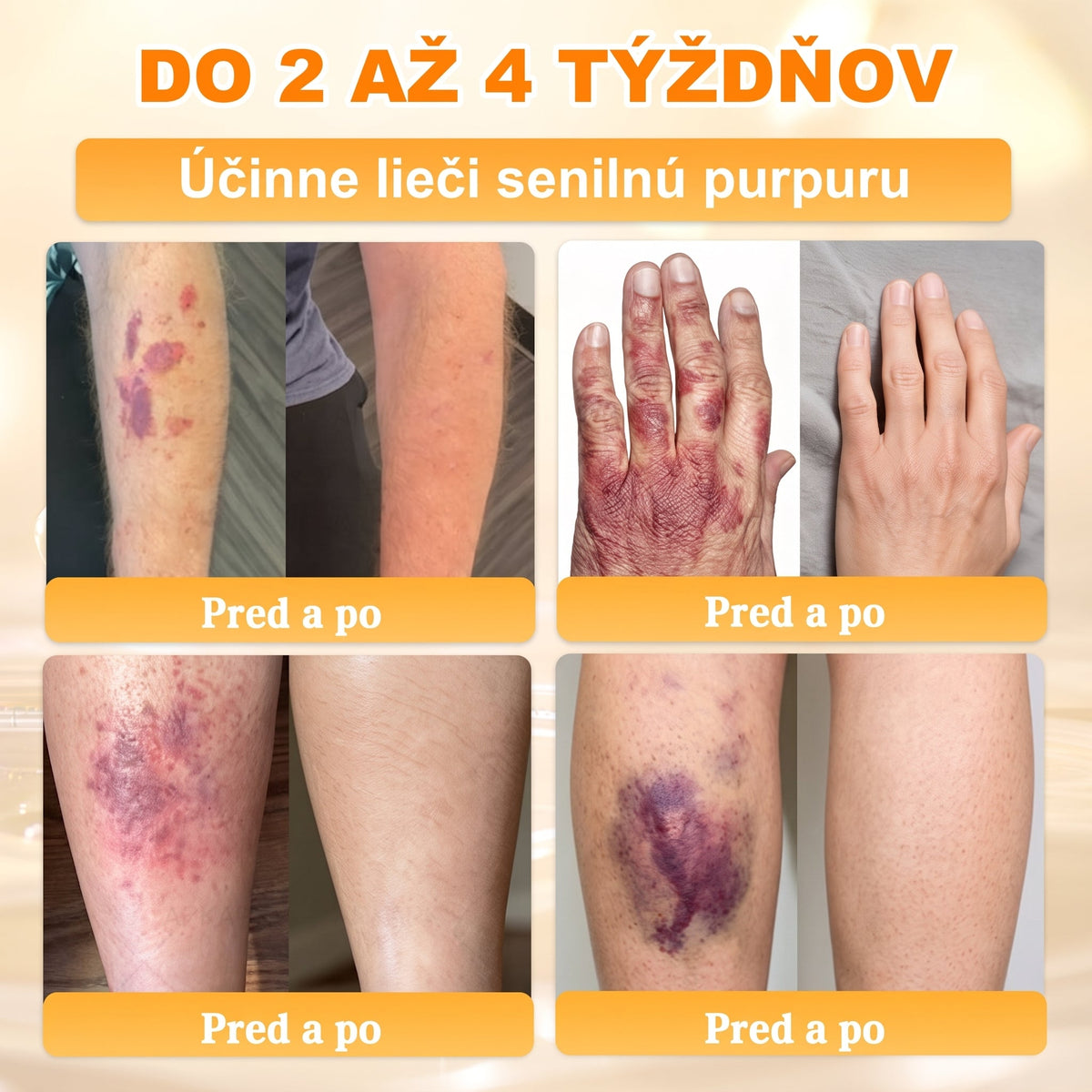 ✨ 🔥 VLSVLS® Včelí jed regeneračný krém na pokožku 🔥 Vyvinuté na Slovensku, vyrobené a dodávané zo Slovenska