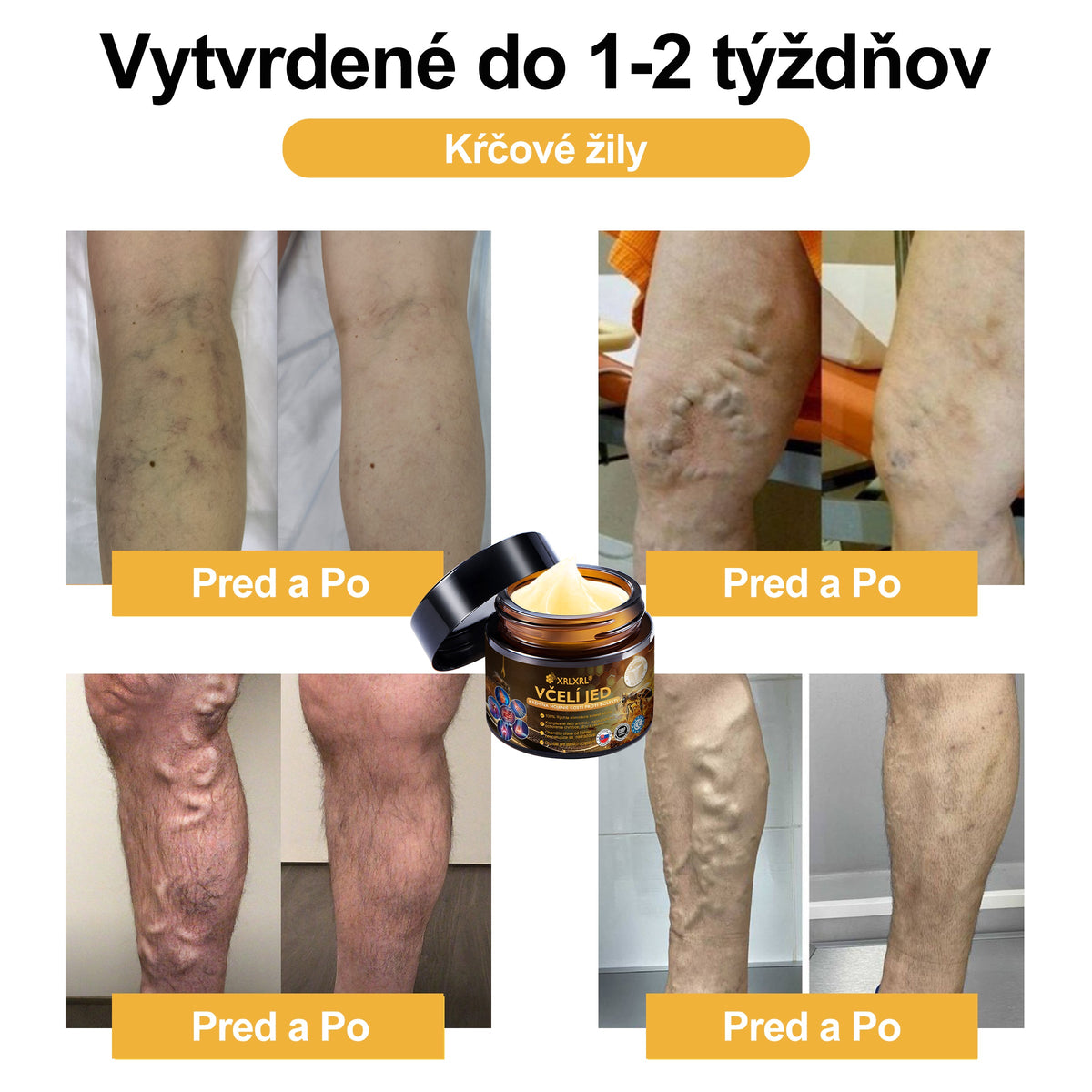 XRLXRL®🎁🎁 Posledná šanca! Získajte ho teraz so zľavou 40 %!