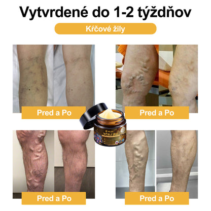 XRLXRL®🎁🎁 Posledná šanca! Získajte ho teraz so zľavou 40 %!