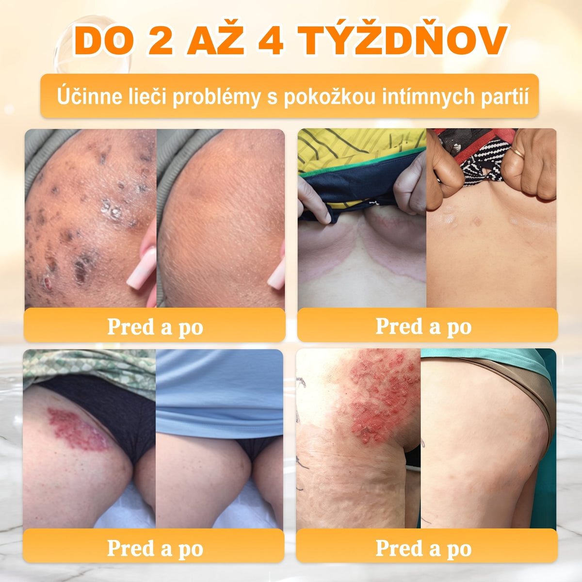 ✨ 🔥 VLSVLS® Včelí jed regeneračný krém na pokožku 🔥 Vyvinuté na Slovensku, vyrobené a dodávané zo Slovenska