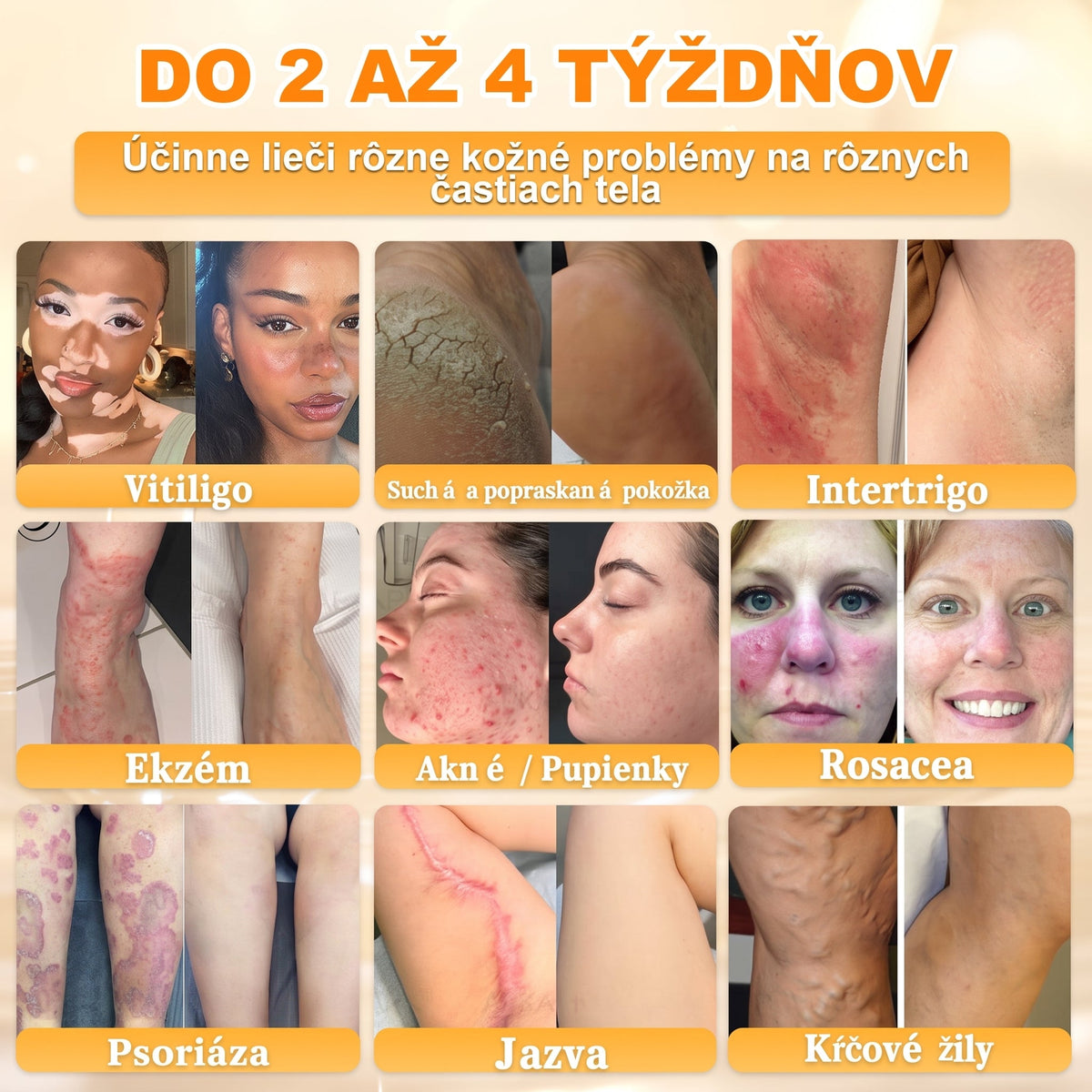 ✨ 🔥 VLSVLS® Včelí jed regeneračný krém na pokožku 🔥 Vyvinuté na Slovensku, vyrobené a dodávané zo Slovenska