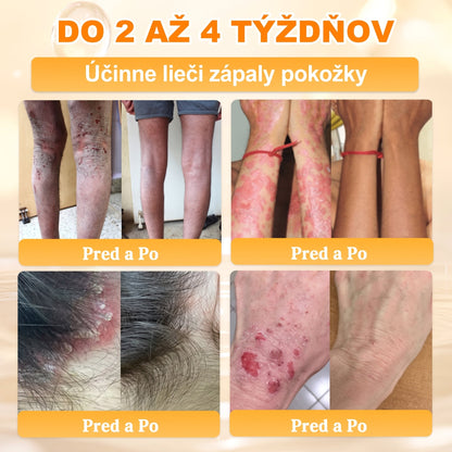 ✨ 🔥 VLSVLS® Včelí jed regeneračný krém na pokožku 🔥 Vyvinuté na Slovensku, vyrobené a dodávané zo Slovenska