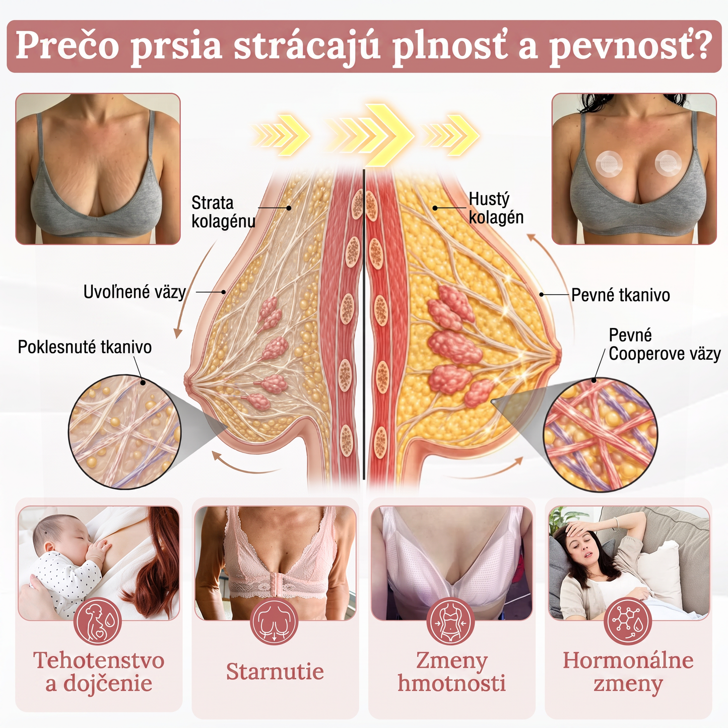 🪸HISKIN® Náplasti s mikroihličkami na zväčšenie objemu, spevnenie a lifting poprsia