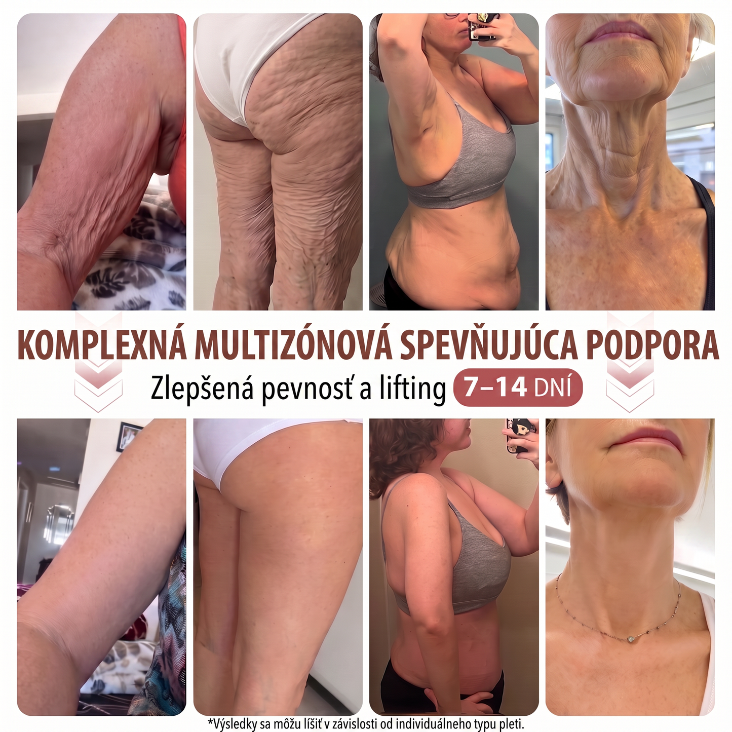💜HISKIN® Náplasti s mikroihličkami na zväčšenie objemu, spevnenie a lifting poprsia
