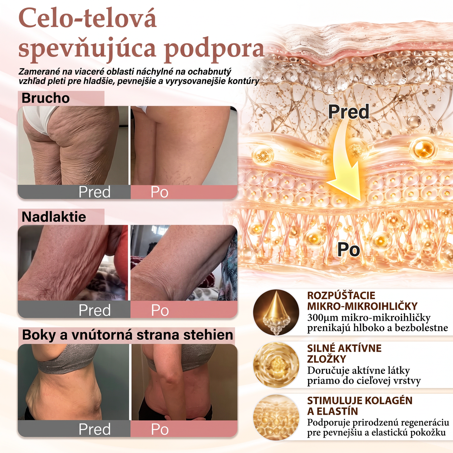 💜HISKIN® Náplasti s mikroihličkami na zväčšenie objemu, spevnenie a lifting poprsia