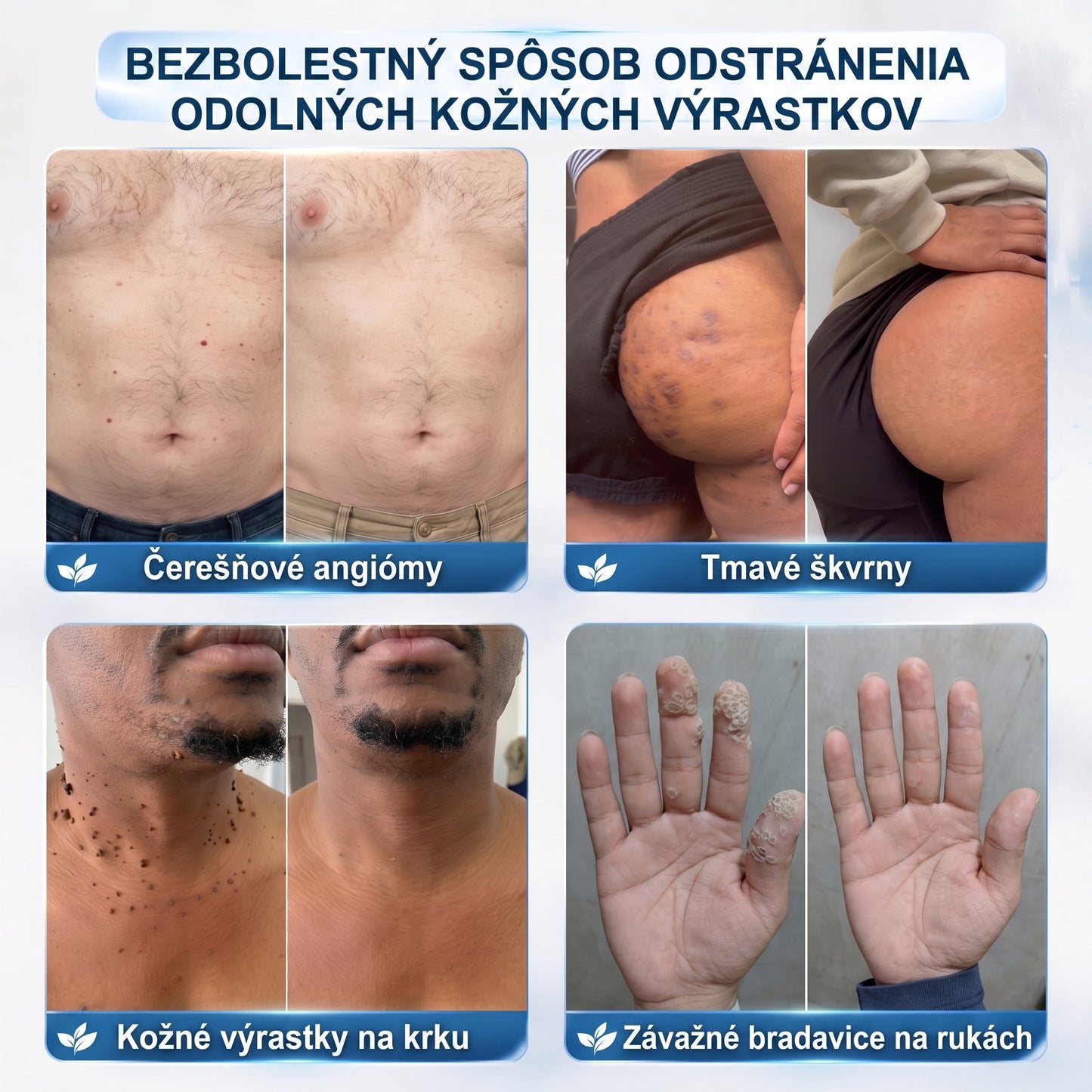 🌟HISKIN®👩‍⚕️ BOTANICKÝ – GUMA NA ŠTÍTKY A ŠKVRNY – Bezbolestná starostlivosť o pokožku bez jaziev s pokročilým guľôčkovým aplikátorom