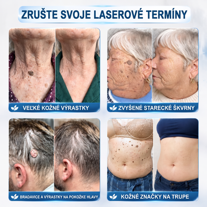 🌟HISKIN®👩‍⚕️ BOTANICKÝ – GUMA NA ŠTÍTKY A ŠKVRNY – Bezbolestná starostlivosť o pokožku bez jaziev s pokročilým guľôčkovým aplikátorom